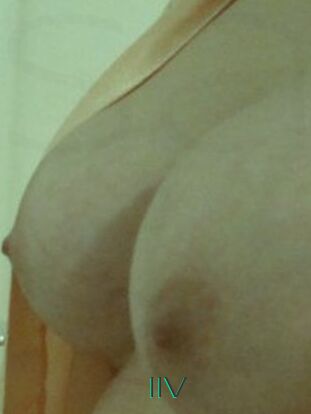 Iiv